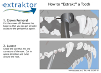 Extraktor Accesia Extraktor Accesia