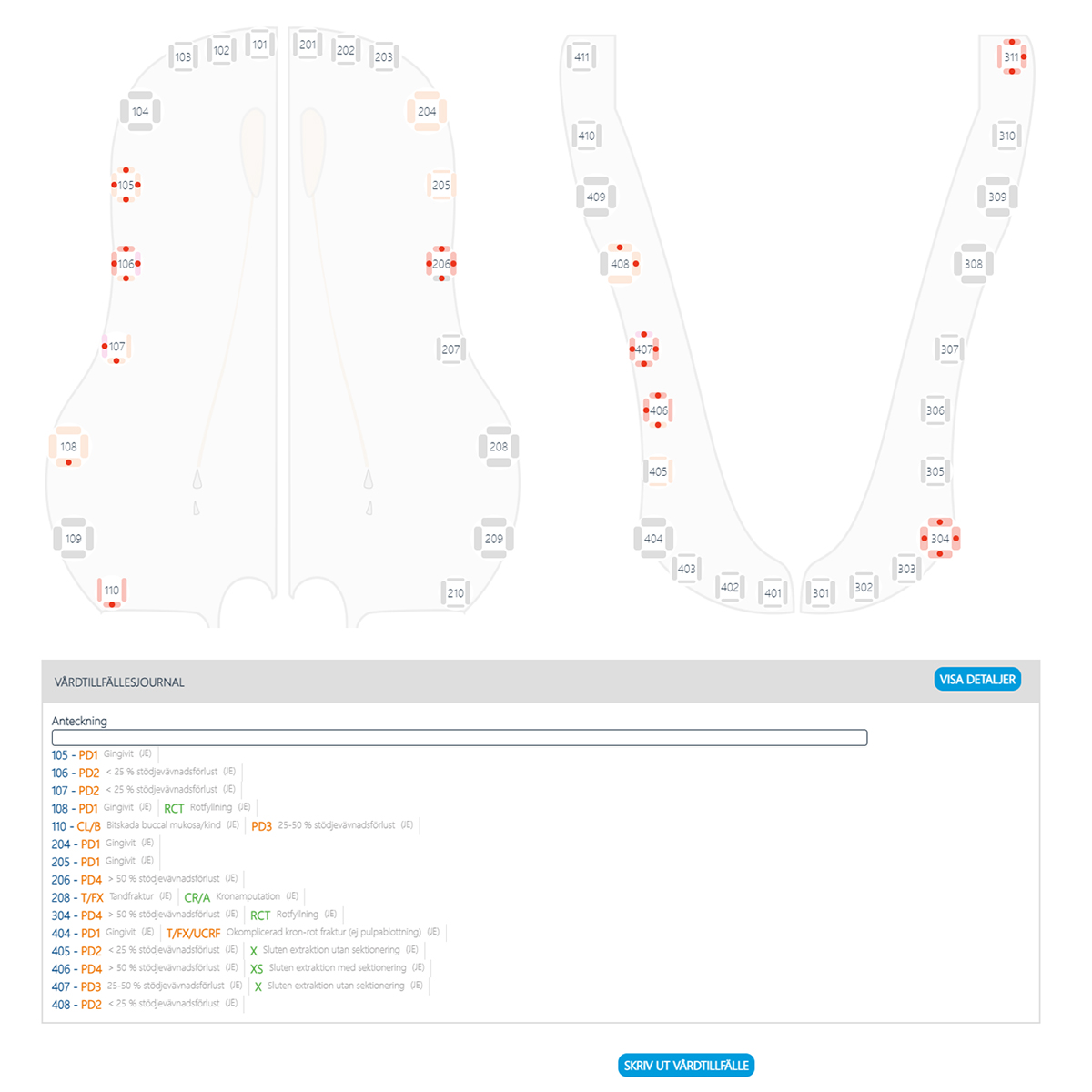 TVÅ TYDLIGA VYER TVÅ TYDLIGA VYER